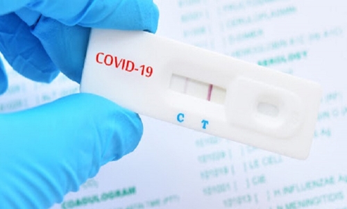 Rapid test &sigma;&tau;&eta;&nu; &kappa;&omicron;&iota;&nu;ό&tau;&eta;&tau;&alpha; &Sigma;&omicron;&chi;&omicron;ύ &tau;&eta;&nu; &Pi;έ&mu;&pi;&tau;&eta; 21 &Iota;&omicron;&upsilon;&lambda;ί&omicron;&upsilon; 2022