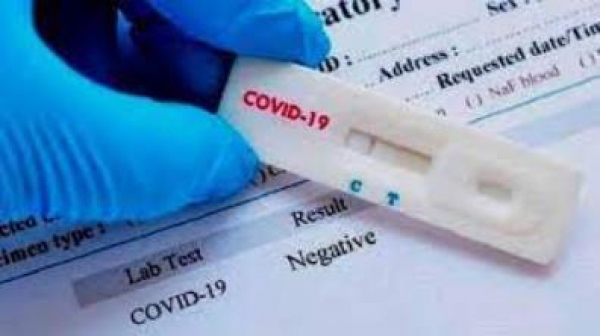 Rapid test &kappa;&omicron;&iota;&nu;ό&tau;&eta;&tau;&alpha; &Lambda;&alpha;&gamma;&kappa;&alpha;&delta;ά 