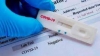 Rapid test &kappa;&omicron;&iota;&nu;ό&tau;&eta;&tau;&alpha; &Lambda;&alpha;&gamma;&kappa;&alpha;&delta;ά 