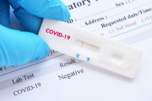 RAPID TESTS &Kappa;&Rho;&Upsilon;&Omicron;&Nu;&Epsilon;&Rho;&Iota;